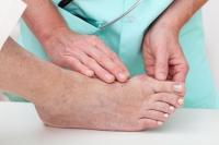 What Is a Bunion?