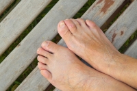 Hammertoe and Flip-Flops